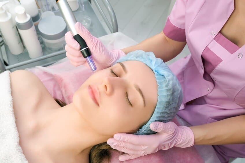 Microneedling