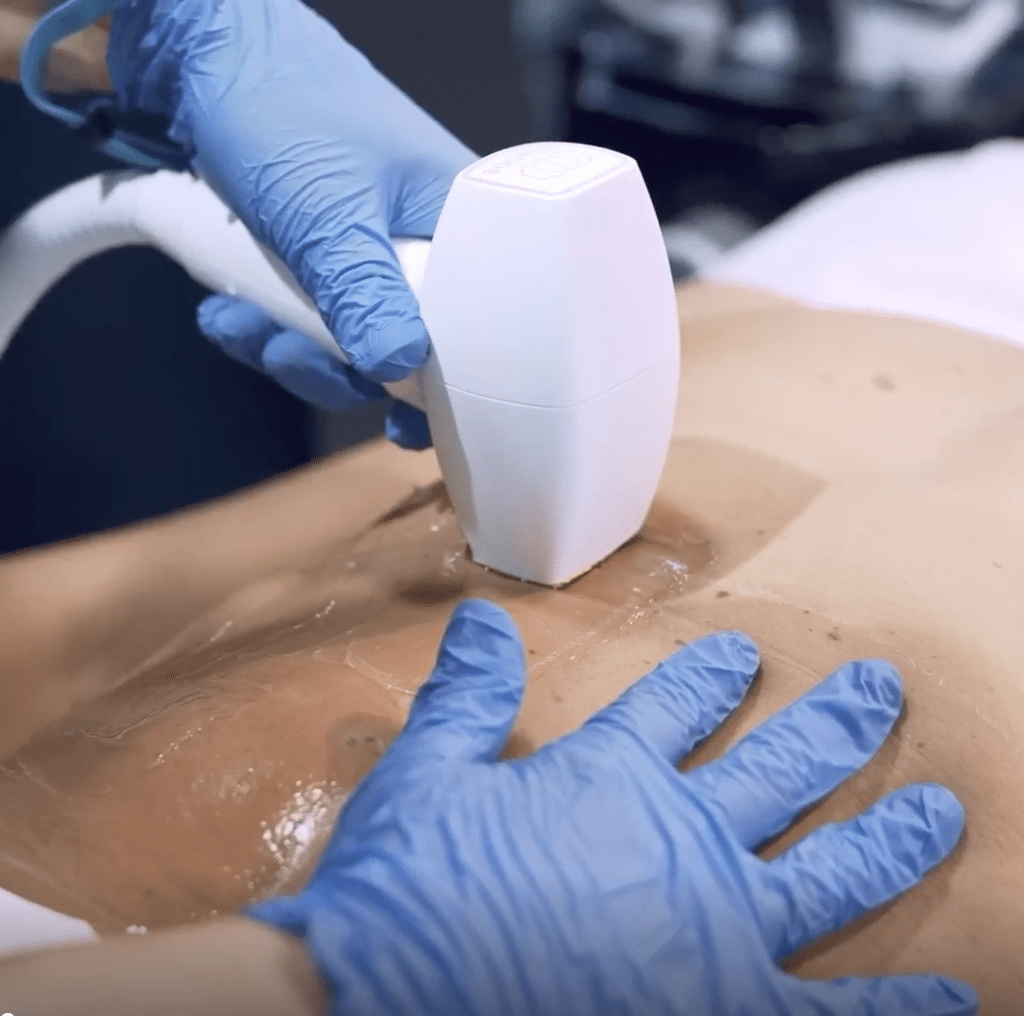 InMode Allure Salon by DreamArtMedia-107