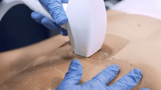 InMode Allure Salon by DreamArtMedia-107